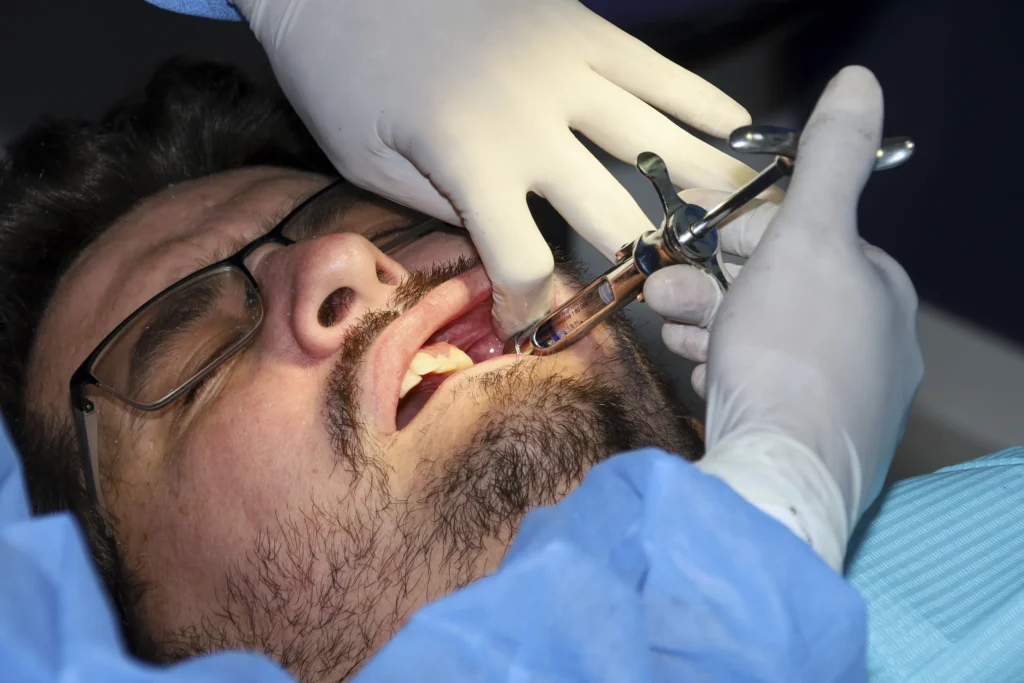 Emergency Tooth Extraction in Fairfield | Immediate Dental Care