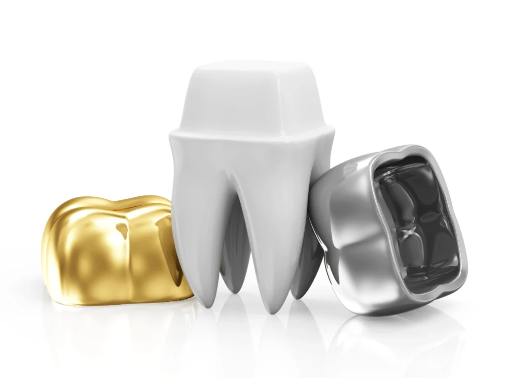 Different types of dental crowns including gold, porcelain, and metal used in Fairfield restorative dentistry