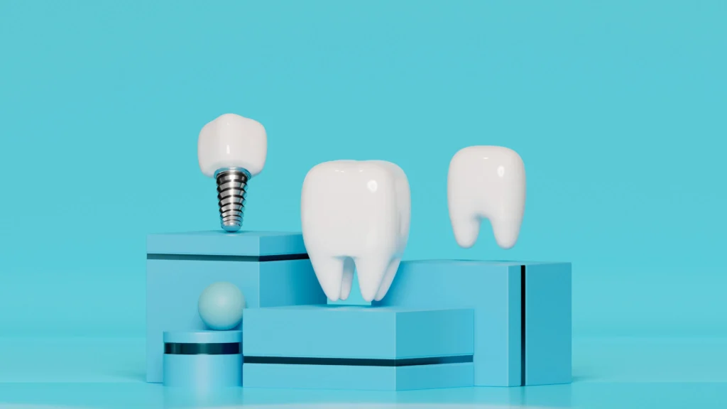 3D illustration of a dental implant next to natural teeth on a blue background, representing tooth replacement options.