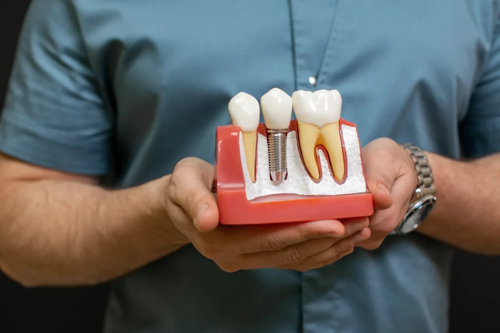 A dentist holding a model of a dental implant and natural teeth, used to explain tooth replacement options to patients